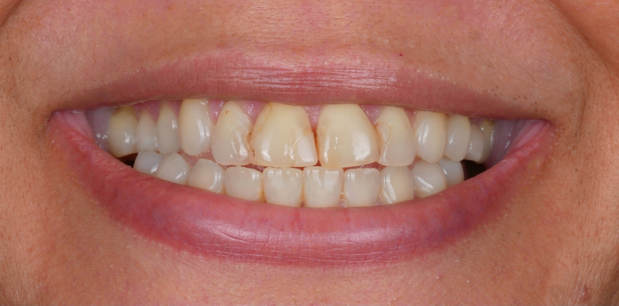 Before7 - One Dental Group Before7 - One Dental Group