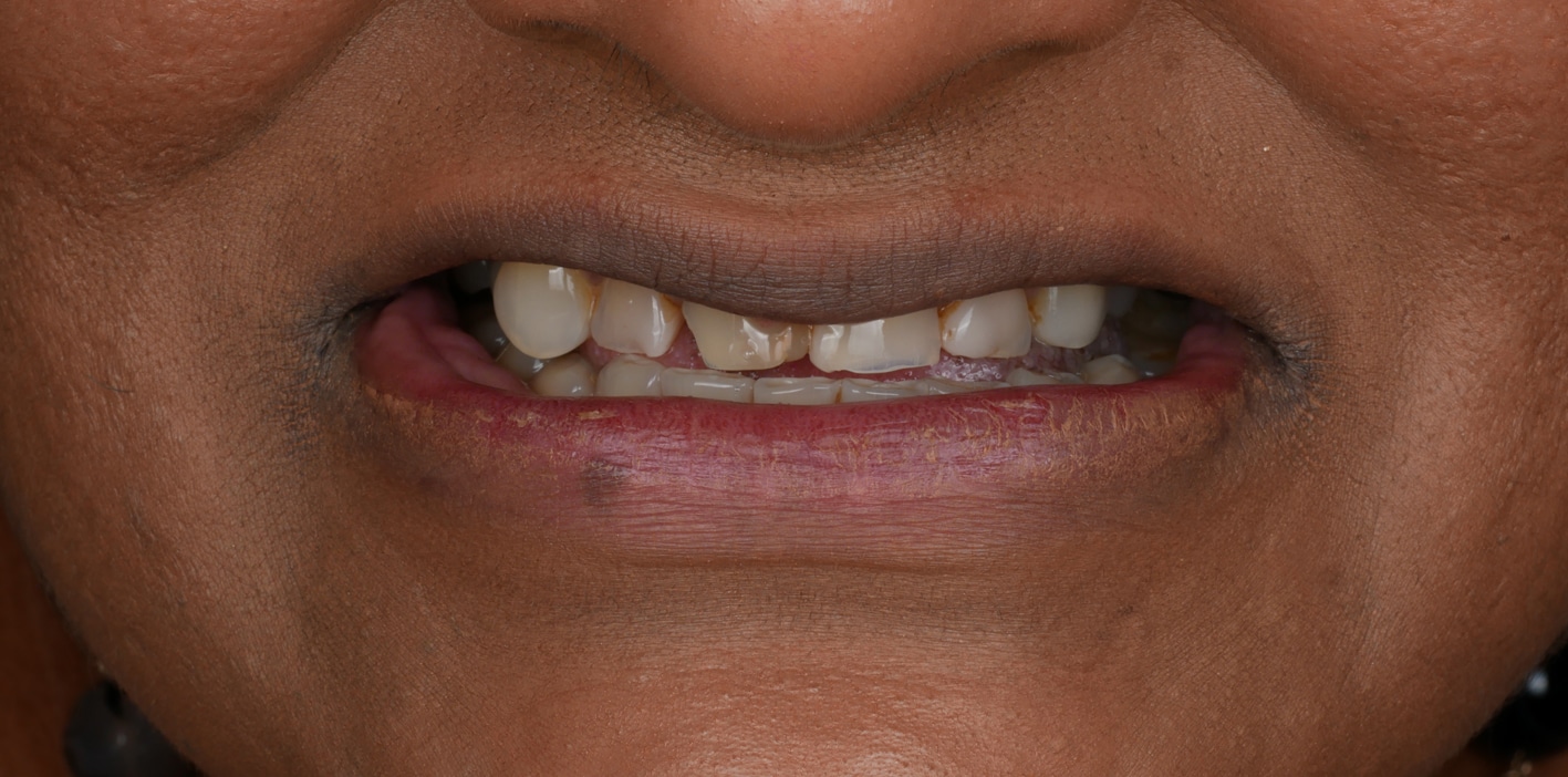 Before9 - One Dental Group Before9 - One Dental Group