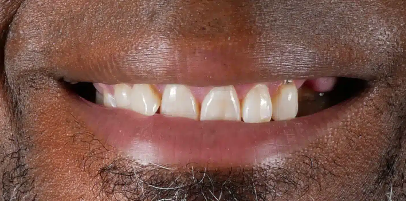 kurt before.jpg - One Dental Group kurt before.jpg - One Dental Group